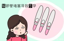 输卵管堵塞要怎么检查