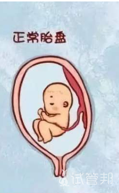 胎盘成熟度3级是什么意思？