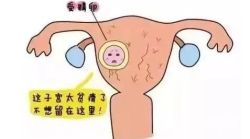 子宫内膜厚度薄怎么治疗？