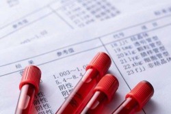 睾丸发育不良对生育的影响