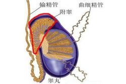 睾丸右侧附睾囊肿能根治吗?