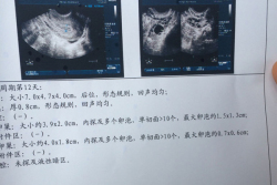 在扬州市妇幼保健院人工授精成功，简直是天大的惊喜！